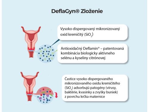 DeflaGyn® aplikačná súprava 3 ks