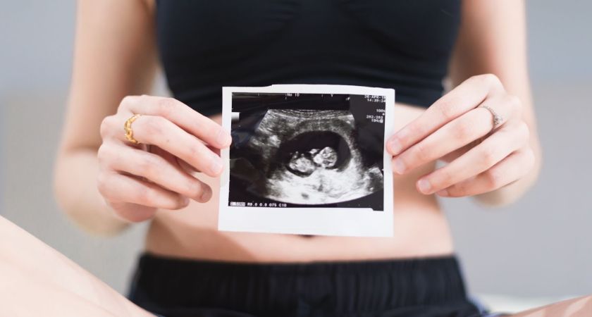 12. týždeň tehotenstva - 12. tt